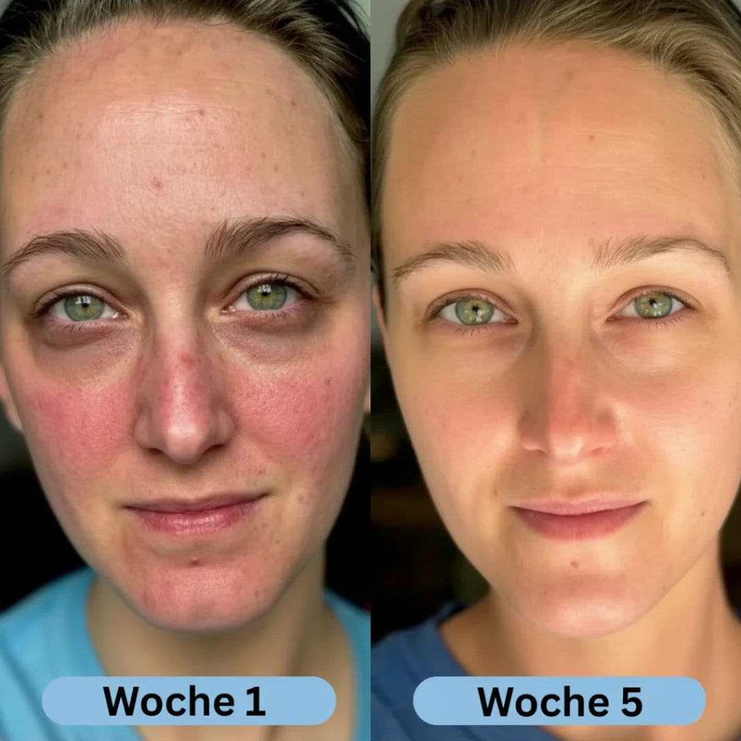 VoluFine | Koreanisches Kollagen-Serum für reife Haut