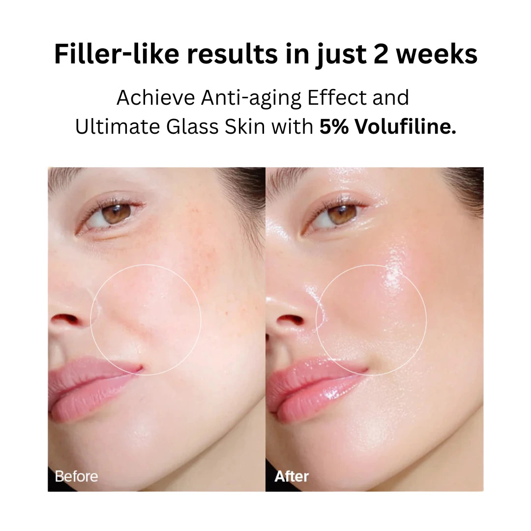 VoluFine | Koreanisches Kollagen-Serum mit Volufiline
