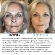 VoluFine | Kollagen-Serum mit Volufiline