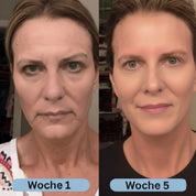 VoluFine | Kollagen-Serum mit Volufiline